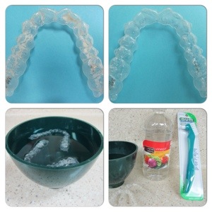 How To Clean a Crusty Invisalign Tray or Retainer at Home