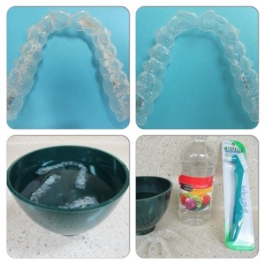 How Do You Clean Your Invisalign Retainers & Tray?