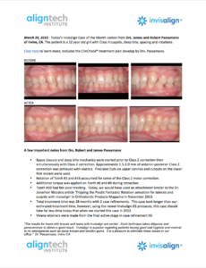 Invisalign Case of the Month Passamano Irvine CA