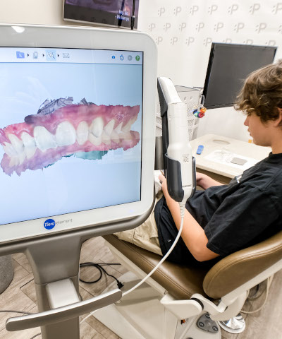 Invisalign Teen - Passamano Orthodontics - Irvine, CA